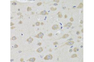 Immunohistochemistry of paraffin-embedded Rat brain using DHRS9 Polyclonal Antibody at dilution of 1:100 (40x lens). (DHRS9 anticorps)