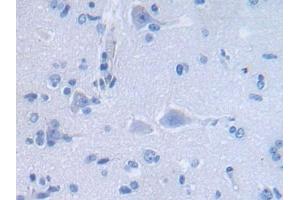 Detection of DEFa3 in Human Cerebrum Tissue using Polyclonal Antibody to Defensin Alpha 3, Neutrophil Specific (DEFa3)