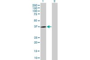 Western Blot analysis of KLRC1 expression in transfected 293T cell line by KLRC1 MaxPab polyclonal antibody.