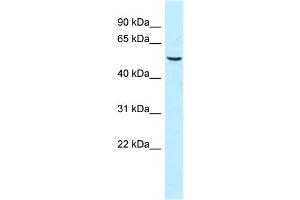 WB Suggested Anti-SNX8 Antibody Titration: 1. (SNX8 anticorps  (C-Term))