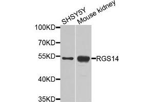 Western blot analysis of extracts of various cells, using RGS14 antibody. (RGS14 anticorps)