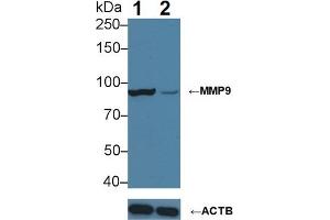 Knockout Varification: Lane 1: Wild-type HepG2 cell lysate; Lane 2: MMP9 knockout HepG2 cell lysate; Predicted MW: 76kDa Observed MW: 90kDa Primary Ab: 3µg/ml Mouse Anti-Human MMP9 Antibody Second Ab: 0. (MMP 9 anticorps  (AA 213-399))