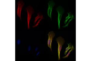 ABIN6257932 and ABIN6275132 staining Hela cells by IF/ICC. (ALDOB anticorps  (C-Term))