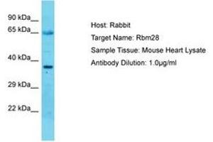Image no. 1 for anti-RNA Binding Motif Protein 28 (RBM28) (C-Term) antibody (ABIN6750305) (RBM28 anticorps  (C-Term))