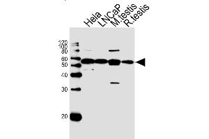 Lane 1: HeLa Cell lysates, Lane 2: LNCaP Cell lysates, Lane 3: Mouse testis lysates, Lane 4: Rat testis lysates, probed with ULK3 (1404CT148. (ULK3 anticorps)