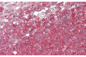 Detection of BCHE in Human Spleen Tissue using Polyclonal Antibody to Butyrylcholinesterase (BCHE)