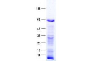 Validation with Western Blot