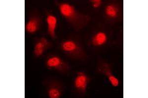 Immunofluorescent analysis of AMPK alpha 1 (pS496) staining in HUVEC cells. (PRKAA1 anticorps  (C-Term, pSer496))
