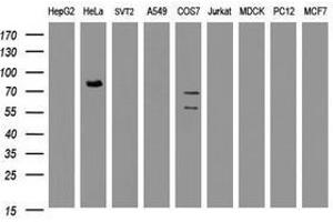 Image no. 2 for anti-HBS1-Like (HBS1L) (AA 1-242) antibody (ABIN1490627) (HBS1L anticorps  (AA 1-242))