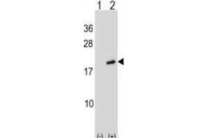 Western Blotting (WB) image for anti-ADP-Ribosylation Factor-Like 2 (ARL2) antibody (ABIN2998892) (ARL2 anticorps)