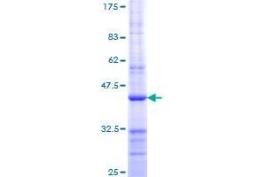 Image no. 1 for Retinoblastoma 1 (RB1) (AA 371-470) protein (GST tag) (ABIN1317543) (Retinoblastoma 1 Protein (RB1) (AA 371-470) (GST tag))