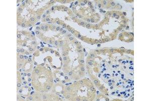 Immunohistochemistry of paraffin-embedded Mouse kidney using CHMP1B Polyclonal Antibody at dilution of 1:100 (40x lens). (CHMP1B anticorps)
