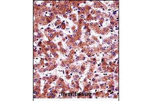 BP Antibody (N-term) (ABIN657686 and ABIN2846678) immunohistochemistry analysis in formalin fixed and paraffin embedded human liver tissue followed by peroxidase conjugation of the secondary antibody and DAB staining. (AMBP anticorps  (N-Term))