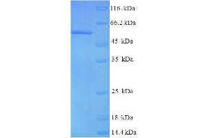 SDS-PAGE (SDS) image for Family with Sequence Similarity 82, Member A2 (FAM82A2) (AA 1-470), (full length) protein (His tag) (ABIN5711565)