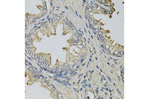 Immunohistochemistry of paraffin-embedded human prostate using LITAF Antibody (ABIN6130523, ABIN6143254, ABIN6143255 and ABIN6221131) at dilution of 1:100 (40x lens).