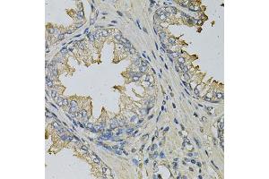 Immunohistochemistry of paraffin-embedded human prostate using LITAF Antibody (ABIN6130523, ABIN6143254, ABIN6143255 and ABIN6221131) at dilution of 1:100 (40x lens). (LITAF anticorps  (AA 1-161))