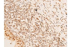 ABIN6267218 at 1/100 staining human TB tissue sections by IHC-P.