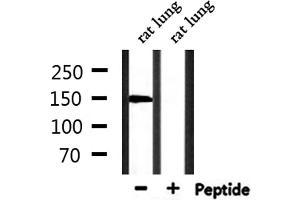 Western blot analysis of extracts from rat lung, using SLK Antibody. (SLK anticorps  (C-Term))