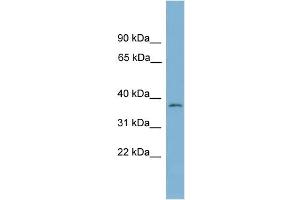 WB Suggested Anti-NUBP1 Antibody Titration: 0. (NUBP1 anticorps  (Middle Region))