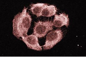 Immunofluorescence staining of A431 cells (Human epithelial carcinoma, ATCC CRL-1555). (PTPN11 anticorps  (AA 1-177))