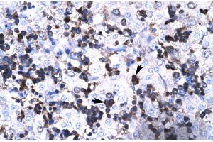Human Liver (FOXP3 anticorps  (N-Term))