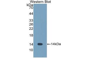 Detection of Recombinant CST1, Human using Polyclonal Antibody to Cystatin 1 (CST1) (CSTL1 anticorps  (AA 21-114))