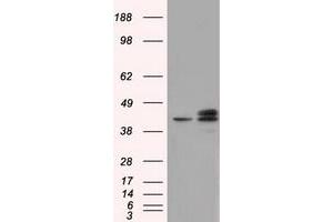 Image no. 2 for anti-Nucleoredoxin-Like 2 (NXNL2) antibody (ABIN1499887) (NXNL2 anticorps)
