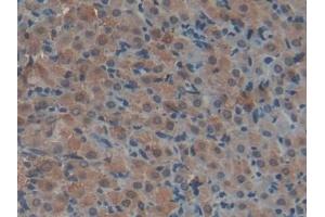 Detection of F2 in Rat Uterus Tissue using Polyclonal Antibody to Coagulation Factor II (F2)