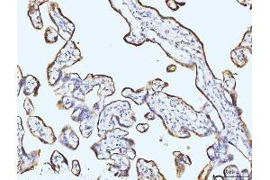 IHC analysis of BZW2 using anti-BZW2 antibody (ABIN7600608).