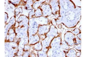 Formalin-fixed, paraffin-embedded human Placenta stained with PAPP-A Mouse Monoclonal Antibody (PAPPA/2715). (PAPPA anticorps  (AA 351-523))