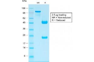 anti-Immunoglobulin Heavy Chain (Gamma Polypeptide) (IGHG) antibody