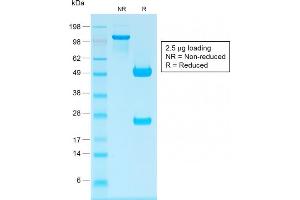 SDS-PAGE Analysis Purified IgG Rabbit Recombinant Monoclonal Antibody (IG1707R). (Recombinant IGHG anticorps)