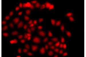 Immunofluorescence analysis of A549 cell using MLF1 antibody. (MLF1 anticorps)