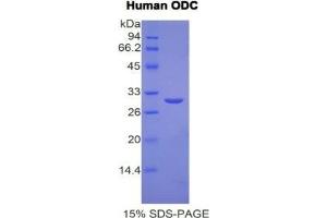 SDS-PAGE analysis of Human ODC Protein.