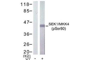 Image no. 2 for anti-Mitogen-Activated Protein Kinase Kinase 4 (MAP2K4) (pSer80) antibody (ABIN196911) (MAP2K4 anticorps  (pSer80))