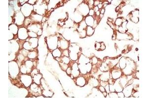 Mouse visceral fat tissue was stained by Rabbit Anti-Adiponutrin (436-481) (Human) Serum (PNPLA3 anticorps  (AA 436-481))