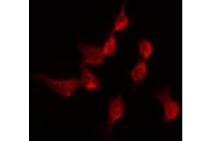 ABIN6274344 staining Hela by IF/ICC. (TDG anticorps  (Internal Region))
