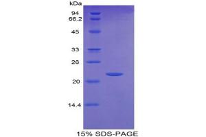 SDS-PAGE analysis of Mouse GCSFR Protein. (CSF3R Protéine)