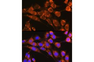 Immunofluorescence analysis of NIH-3T3 cells using CFP Rabbit pAb (ABIN6127651, ABIN6138467, ABIN6138468 and ABIN6221045) at dilution of 1:100 (40x lens). (CFP anticorps  (AA 190-469))