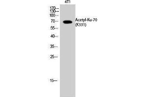 Western Blotting (WB) image for anti-X-Ray Repair Complementing Defective Repair in Chinese Hamster Cells 6 (XRCC6) (acLys331) antibody (ABIN3181899)