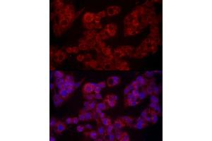 Immunofluorescence analysis of HepG2 cells using LEP Rabbit pAb (ABIN1513150, ABIN3021883, ABIN3021885 and ABIN6216821) at dilution of 1:100 (40x lens).