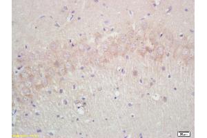 Formalin-fixed and paraffin embedded rat brain labeled with Rabbit Anti Annexin A13 Polyclonal Antibody, Unconjugated (ABIN671181) at 1:200 followed by conjugation to the secondary antibody and DAB staining (Aquaporin 4 anticorps  (AA 271-323))