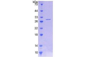 SDS-PAGE analysis of Human PAH Protein. (Phenylalanine Hydroxylase Protéine)
