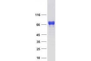 Validation with Western Blot