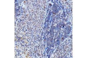 Immunohistochemistry of paraffin-embedded rat spleen using DGCR8 Rabbit pAb (ABIN7266761) at dilution of 1:200 (40x lens). (DGCR8 anticorps)