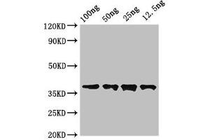 Western Blot Positive WB detected in Recombinant protein All lanes: DST antibody at 3. (Dystonin anticorps  (AA 1-195))