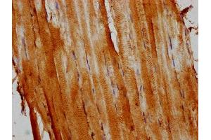 IHC image of ABIN7139708 diluted at 1:400 and staining in paraffin-embedded human skeletal muscle tissue performed on a Leica BondTM system.