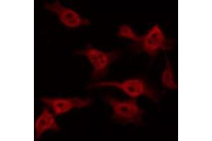 ABIN6267606 staining NIH-3T3 by IF/ICC.