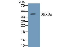 Detection of Recombinant ALPL, Human using Monoclonal Antibody to Alkaline Phosphatase, Tissue-nonspecific (ALPL)