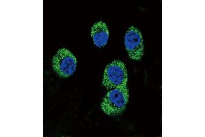 Confocal immunofluorescent analysis of RAGE Antibody (Center) (ABIN390897 and ABIN2841104) with MDA-M cell followed by Alexa Fluor 488-conjugated goat anti-rabbit lgG (green).